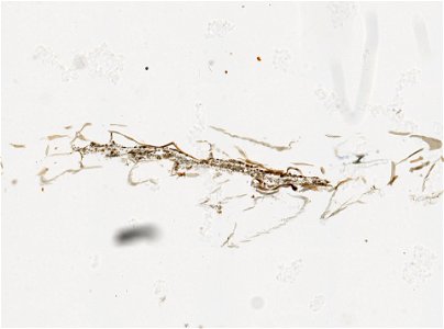 PRESERVED_SPECIMEN; ; ; microslide; IZ number 97762; lot count 1; Microslide 01, balsam, serial section; Microslide 02, balsam, serial section; Microslide 03, balsam, serial section; Microsl