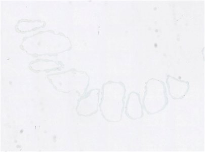 PRESERVED_SPECIMEN; ; ; microslide; IZ number 97602; lot count 1; Microslide 01, balsam, serial section; Microslide 02, balsam, serial section; Microslide 03, balsam, serial section; Microsl