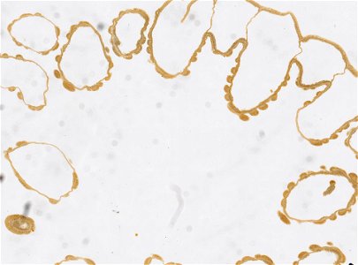 PRESERVED_SPECIMEN; ; ; microslide; IZ number 97602; lot count 1; Microslide 01, balsam, serial section; Microslide 02, balsam, serial section; Microslide 03, balsam, serial section; Microsl