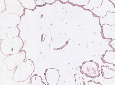 PRESERVED_SPECIMEN; ; ; microslide; IZ number 97602; lot count 1; Microslide 01, balsam, serial section; Microslide 02, balsam, serial section; Microslide 03, balsam, serial section; Microsl
