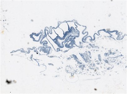 PRESERVED_SPECIMEN; ; ; microslide; IZ number 97606; lot count 1; Microslide 01, balsam, serial section;