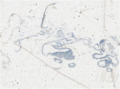 PRESERVED_SPECIMEN; ; ; microslide; IZ number 97611; lot count 1; Microslide 01, balsam, serial section;