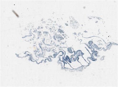 PRESERVED_SPECIMEN; ; ; microslide; IZ number 97615; lot count 1; Microslide 01, balsam, serial section;