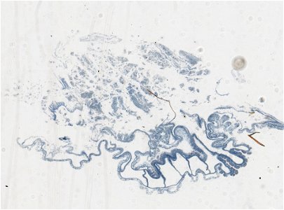 PRESERVED_SPECIMEN; ; ; microslide; IZ number 97618; lot count 1; Microslide 01, balsam, serial section;