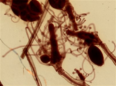 PRESERVED_SPECIMEN; ; ; microslide; IZ number 92537; lot count 1; Microslide 01, balsam, whole mount; other number Set 24-20;