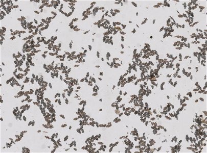 PRESERVED_SPECIMEN; ; ; microslide; IZ number 84657; lot count 1; Microslide 01, balsam, sclerites;