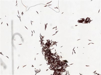 PRESERVED_SPECIMEN; ; ; 70% alc.; microslide; IZ number 10163; lot count 1; Microslide 01, balsam, sclerites;
