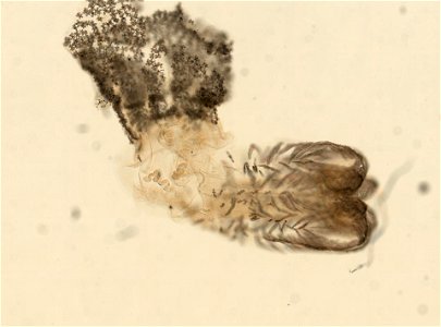 PRESERVED_SPECIMEN; ; ; 70% alc.->dry; microslide; microslide; Gray Museum; IZ number 29406; lot count 1; Microslide 01, balsam, polyps; Microslide 02, balsam, polyps; Microslide 02, bals photo