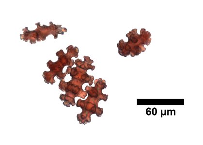 PRESERVED_SPECIMEN; ; ; dry; microslide; microslide; microslide; CSBR Slide Grant Image 2016; IZ number 4523; lot count 1; Microslide 01, balsam, sclerites; Microslide 02, balsam, sclerites;