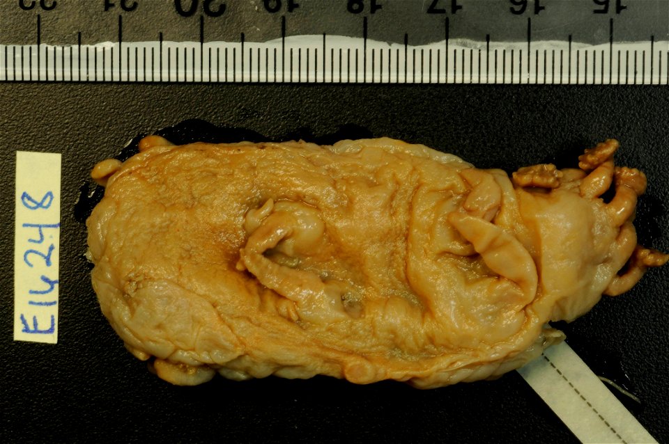 PRESERVED_SPECIMEN; Preparations:	Alcohol (Ethanol); Scotoplanes globosa (Théel, 1879); Individual count:	5; Type status:	 (no data); Identified by:	Agatep, C.; Event date:	19630218T00:00:00Z; Additio