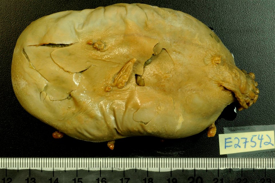PRESERVED_SPECIMEN; Preparations:	Alcohol (Ethanol); Scotoplanes globosa (Théel, 1879); Individual count:	10; Type status:	 (no data); Identified by:	Agatep, C.; Event date:	19640321T00:00:00Z; Additi