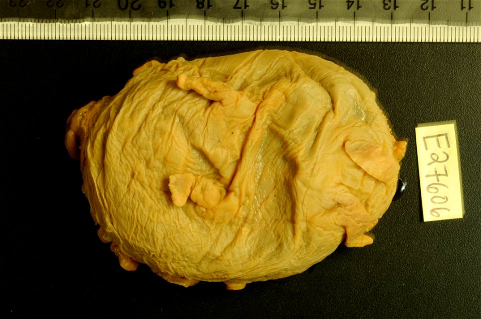 PRESERVED_SPECIMEN; Preparations:	Alcohol (Ethanol); Scotoplanes globosa (Théel, 1879); Individual count:	2; Type status:	 (no data); Identified by:	Carney, Robert S.; Event date:	19630828T00:00:00Z; 