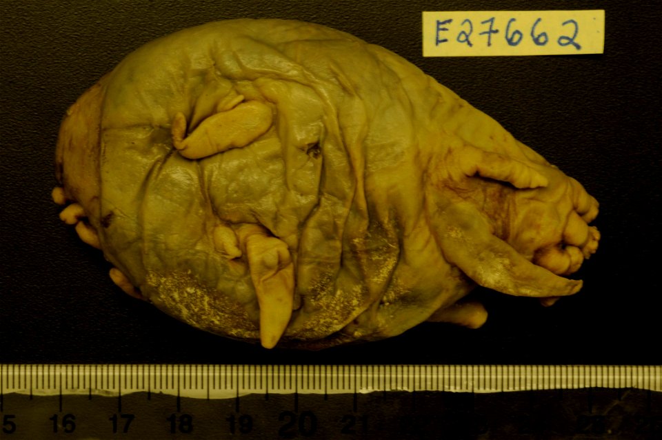 PRESERVED_SPECIMEN; Preparations:	Alcohol (Ethanol); Scotoplanes globosa (Théel, 1879); Individual count:	1; Type status:	 (no data); Identified by:	Carney, Robert S.; Event date:	19750522T00:00:00Z; 