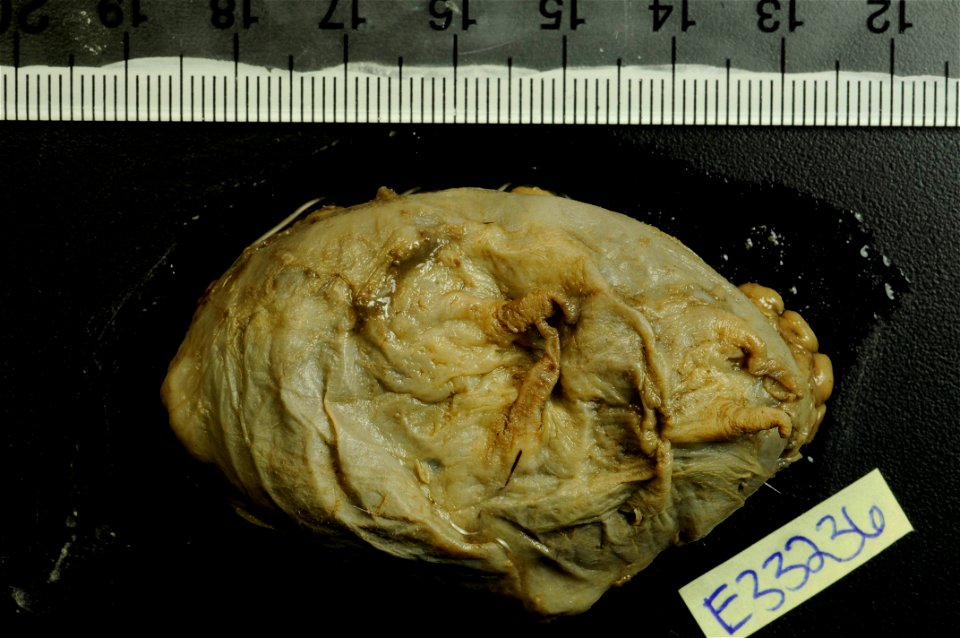 PRESERVED_SPECIMEN; Preparations:	Alcohol (Ethanol); Scotoplanes globosa (Théel, 1879); Individual count:	1; Type status:	 (no data); Identified by:	Ahearn, Cynthia, (IZ), Smithsonian Institution  Nat