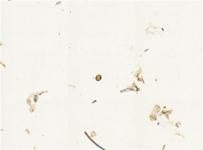 PRESERVED_SPECIMEN; ; ; microslide; ; IZ number 93275; lot count 1; Microslide 01, balsam, whole mount; ova;