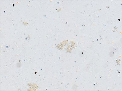 PRESERVED_SPECIMEN; ; ; microslide; ; IZ number 95315; lot count 1; Microslide 01, glycerin, whole mount; egg; other number N-24:III-8;