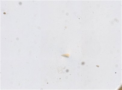 PRESERVED_SPECIMEN; ; LARVA; microslide; ; IZ number 95137; lot count 1; Microslide 01, glycerin, whole mount; larva; other number N-17:III-1; photo