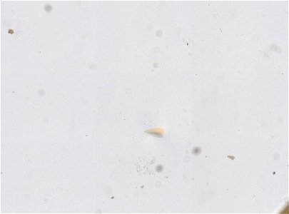 PRESERVED_SPECIMEN; ; LARVA; microslide; ; IZ number 95137; lot count 1; Microslide 01, glycerin, whole mount; larva; other number N-17:III-1;