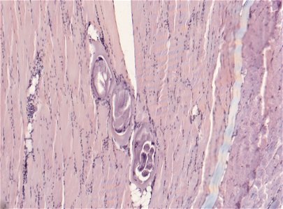 PRESERVED_SPECIMEN; ; ; microslide; ; IZ number 93409; lot count 1; Microslide 01, balsam, section;