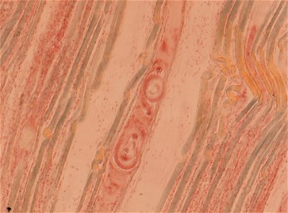 PRESERVED_SPECIMEN; ; ; microslide; ; IZ number 93419; lot count 1; Microslide 01, balsam, section;