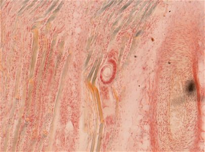 PRESERVED_SPECIMEN; ; ; microslide; ; IZ number 93418; lot count 1; Microslide 01, balsam, section;