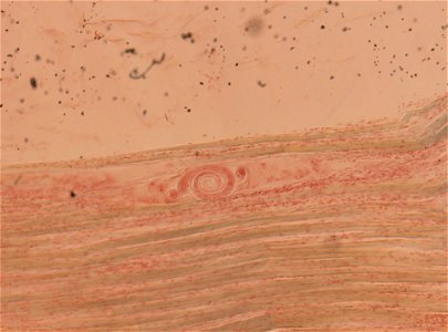 PRESERVED_SPECIMEN; ; ; microslide; ; IZ number 93420; lot count 1; Microslide 01, balsam, section;