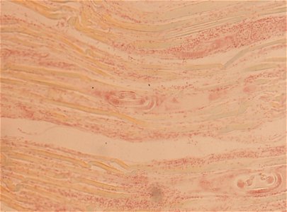 PRESERVED_SPECIMEN; ; ; microslide; ; IZ number 93423; lot count 1; Microslide 01, balsam, section;