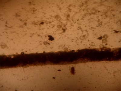Trichinella Spiralis observada en triquinoscopios, después de la digestión artificial. La muestra pertenece a carne de jabalí. La imagen fue tomada por un veterinario habilitado en una sala de tratam photo