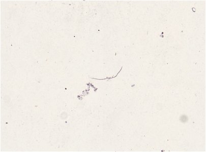 PRESERVED_SPECIMEN; ; ; microslide; ; IZ number 93369; lot count 1; Microslide 01, balsam, section; other number P6.38; photo