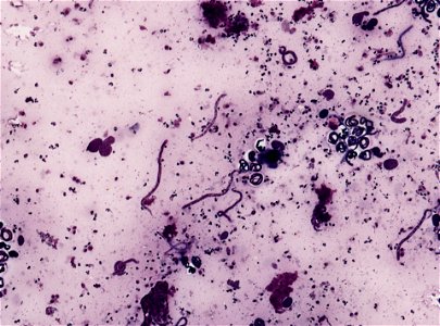 PRESERVED_SPECIMEN; ; ; microslide; ; IZ number 93385; lot count 1; Microslide 01, balsam, section; other number P6.38;