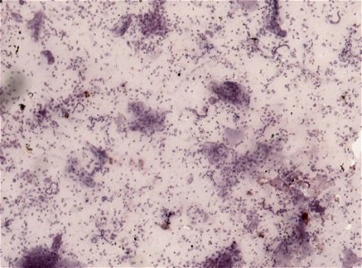PRESERVED_SPECIMEN; ; ; microslide; ; IZ number 93391; lot count 1; Microslide 01, balsam, section; other number P6.38;