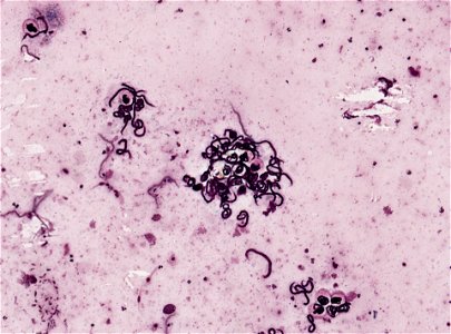 PRESERVED_SPECIMEN; ; ; microslide; ; IZ number 93394; lot count 1; Microslide 01, balsam, section; other number P6.38;