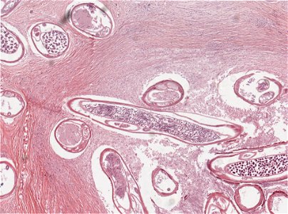 PRESERVED_SPECIMEN; ; ; microslide; ; IZ number 97916; lot count 1; Microslide 01, balsam, section; other number P6.37;