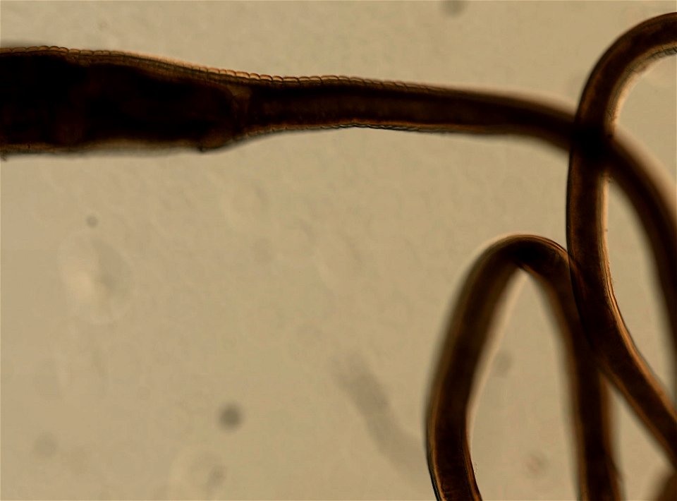 PRESERVED_SPECIMEN; FEMALE; ; microslide; ; IZ number 95150; lot count 1; Microslide 01, balsam, whole mount; female; other number N-22:III-1;