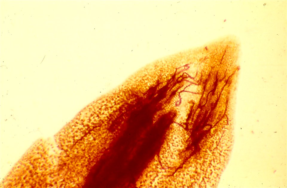 Meloidogyne arenaria (second stage juvenile) in peanut (Arachis hypogea) root