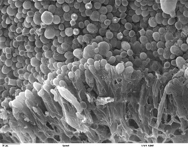 Scanning electron microscope image of mushroom spores. Note the thick stromal layer with basidiospores. Agaricus bisporus