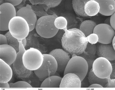 Scanning electron microscope image of budding mushroom spores. Agaricus bisporus photo