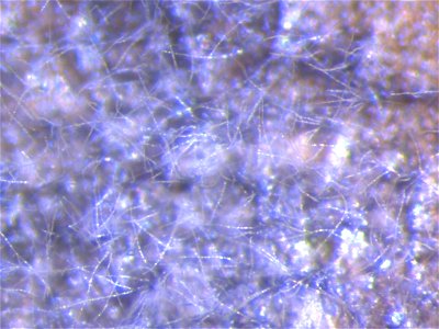 Pathogen: Cercospora beticola After 22 hours of incubation in high humidity, the lesions sporulated profusely. The conidia (spores) appear long and slivery in this light, as a stubble of grey whiskers photo