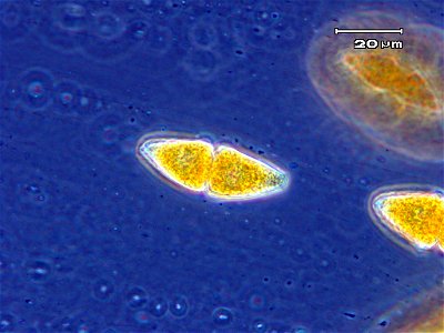 Two-celled teliospore of Gymnosporangium globosum photo