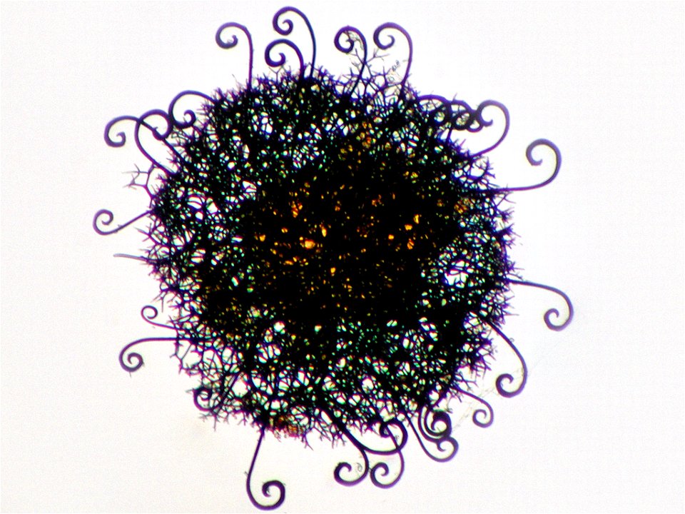 Photomicrograph of Myxotrichum chartarum in bright field microscopy