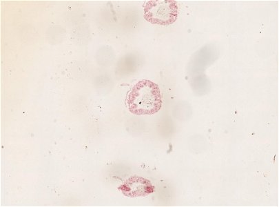 PRESERVED_SPECIMEN; FEMALE; ; microslide; ; IZ number 98954; lot count 1; Microslide 01, balsam, serial section; female;