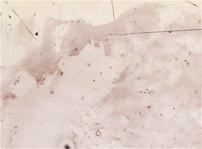 PRESERVED_SPECIMEN; FEMALE; ; microslide; ; IZ number 98955; lot count 1; Microslide 01, balsam, serial section; female;