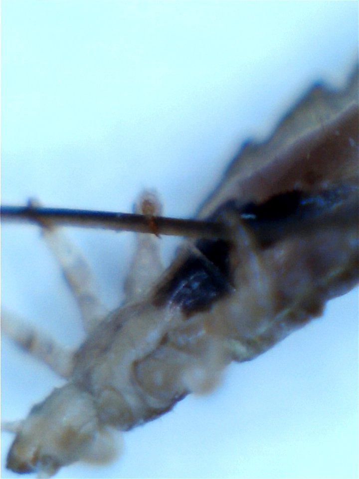 Image of a head louse showing detail of claw gripping a human hair