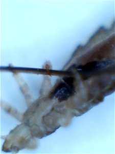 Image of a head louse showing detail of claw gripping a human hair