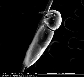 SEM Image of Head Louse Hatching (1,000X Magnification) photo