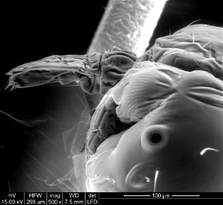 Head Louse Nit Hatching (500X Magnification) photo