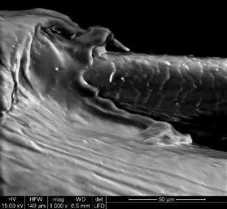 SEM Image of Head Louse Nit Sheath (1,000X Magnification) photo