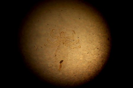 Slide of Pediculus humanis capitus, from teaching slides at the University of Edinburgh.