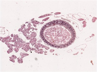 PRESERVED_SPECIMEN; ; ; microslide; ; IZ number 98974; lot count 1; Microslide 01, balsam, mid-gut, serial section; Microslide 02, balsam, mid-gut, serial section; Microslide 03, balsam