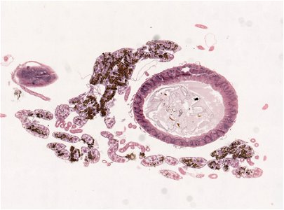 PRESERVED_SPECIMEN; ; ; microslide; ; IZ number 98974; lot count 1; Microslide 01, balsam, mid-gut, serial section; Microslide 02, balsam, mid-gut, serial section; Microslide 03, balsam